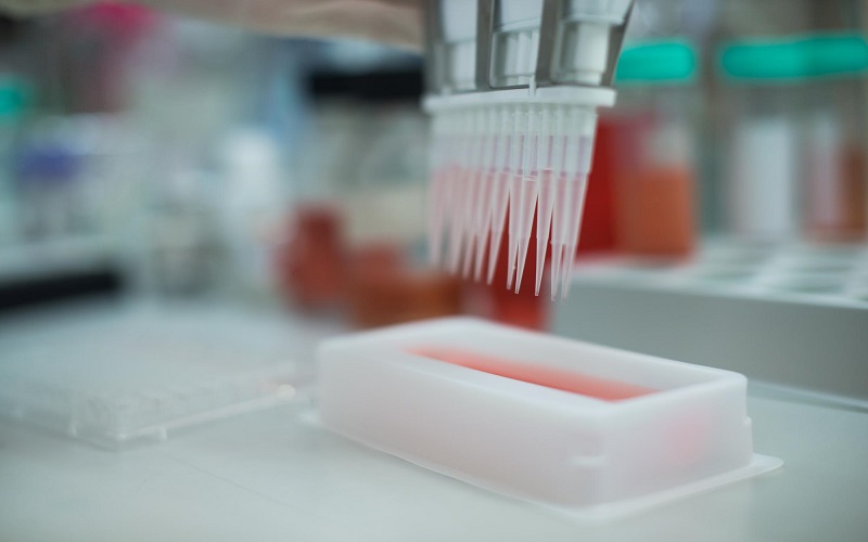 مزایای آزمایش PCR