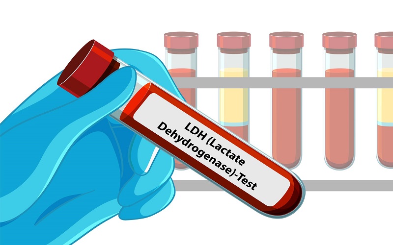 آنزیم LDH چگونه عمل می‌کند؟