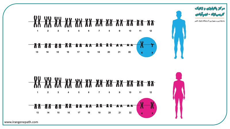 مطالعه کروموزومی در تشخیص پس از تولد